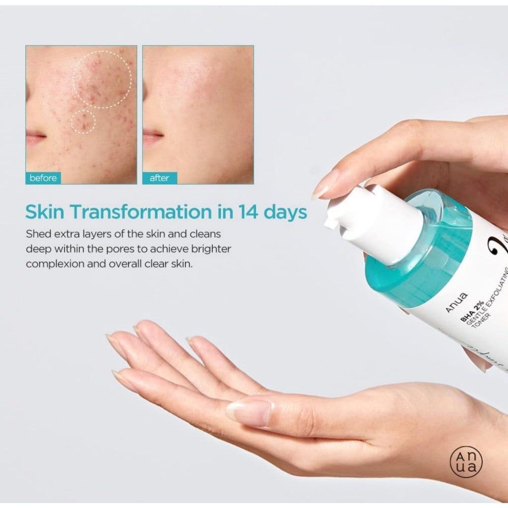 ANUA BHA 2% Gentle Exfoliating Toner 150ml