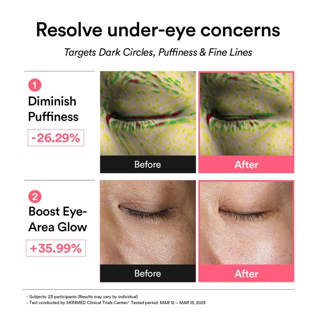 Abib Eye Patch, 60 Pieces (2 Types) | Collagen Jericho Rose Jelly / PDRN Retinal Glow