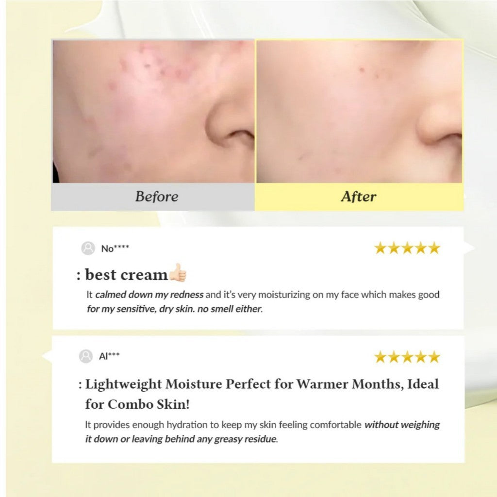 [Dr.Althea] 345 Relief Cream, 50mL - Lightweight Post-Acne Care