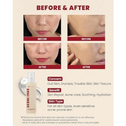 K-SECRET SEOUL 1988 Essence : Snail Mucin 97% + Rice 100ml