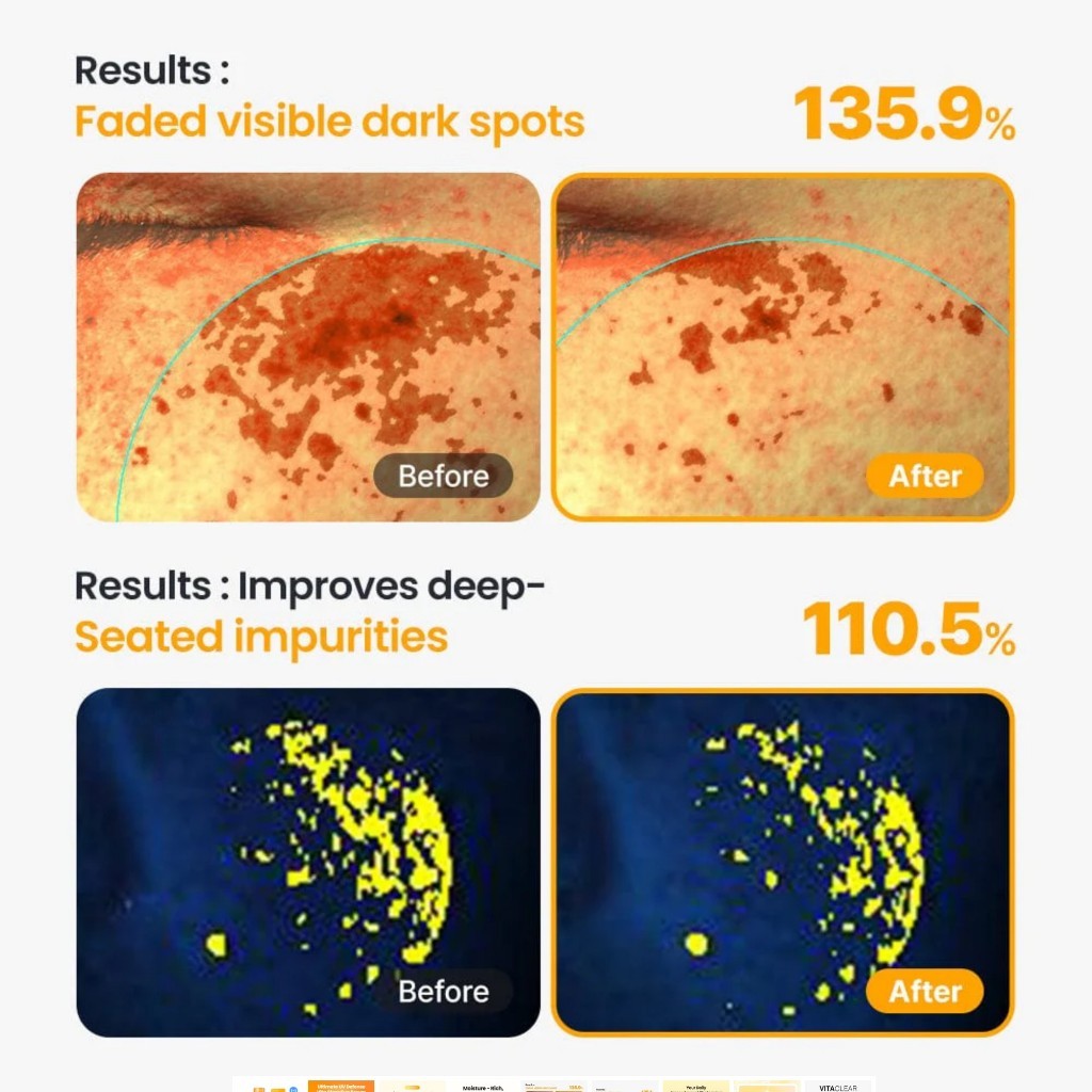 Dr.G VITA CLEAR SUN SERUM, 50mL / WATER PROOF SUNSTICK, 21g (SPF50+/PA++++)