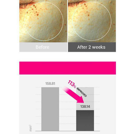 [NEW] ISOI Blemish Care Eye & Wrinkle Patch 90P