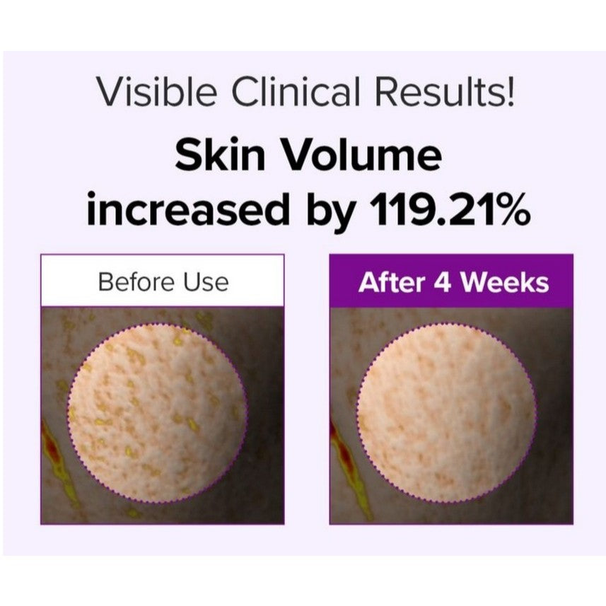 MARY&MAY Crema de espículas con PDRN 15g, 2 tipos (colágeno, retinol)