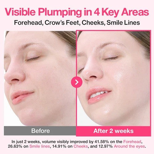 Numbuzin No.2 Rose PDRN Collagen Plumping Serum Duo, 10ml (Mild 1ml*5ea+Intensive 1ml*5ea)