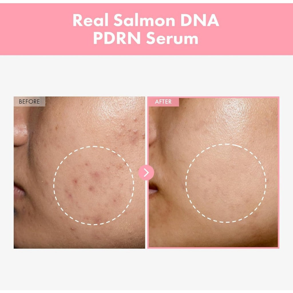 TOSOWOONG Niacinamide 10% + Tranexamic Acid 4% Serum / Pink Peptide 12 PDRN Serum, 33mL