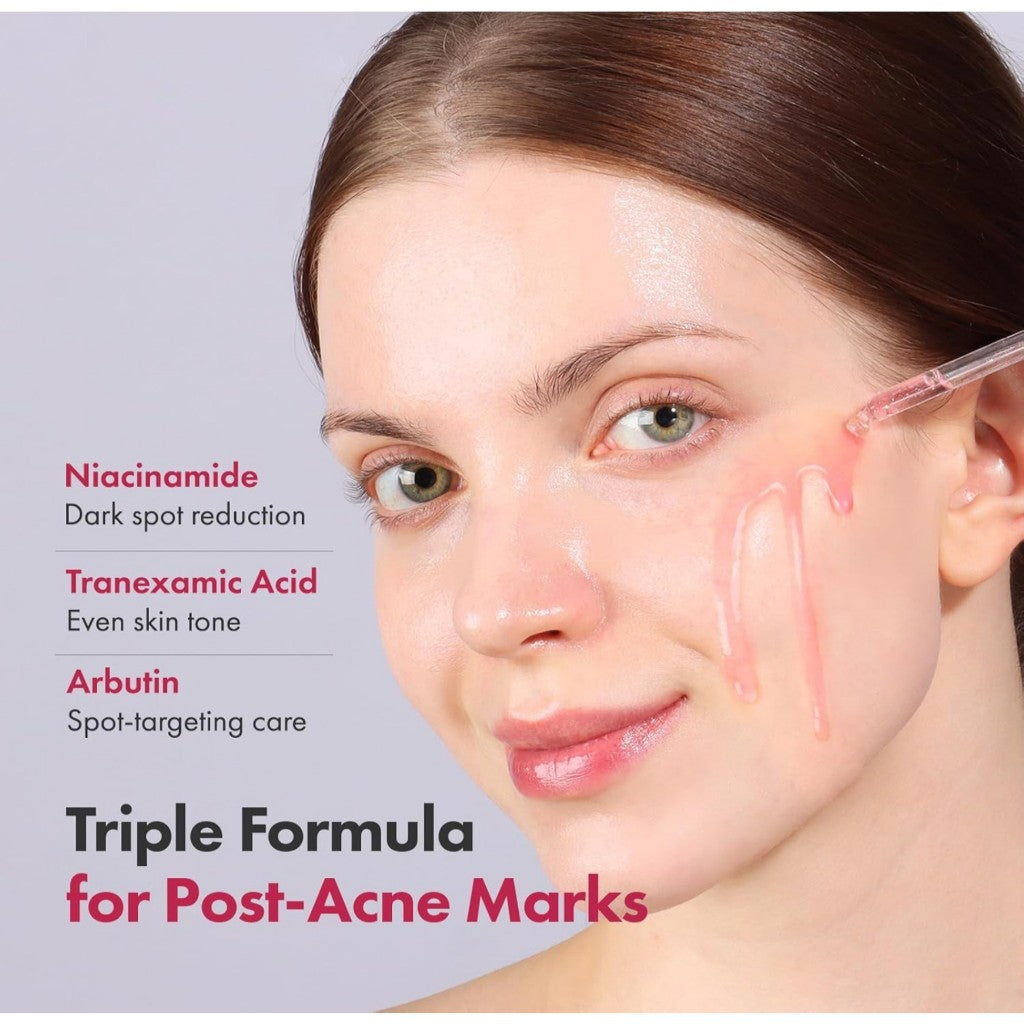 TOSOWOONG Niacinamide 10% + Tranexamic Acid 4% Serum / Pink Peptide 12 PDRN Serum, 33mL