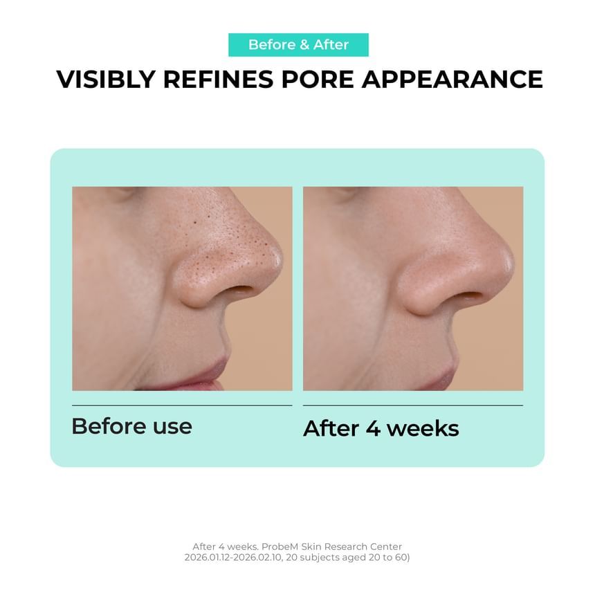 JUMISO Overnight Zero pore Nose patch, 10EA