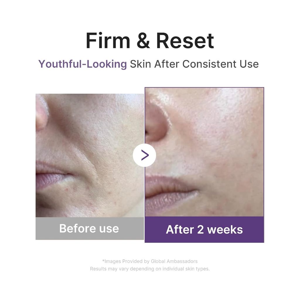 MEDICUBE Retinol Boosting Serum 1.9% , 30mL