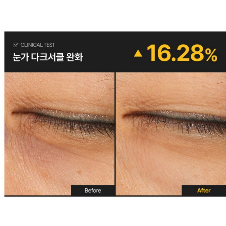 [RENEWED] Mediheal Collagen Capsule Patch ( Retinol / Vitamin C) (2 Types) 60ea