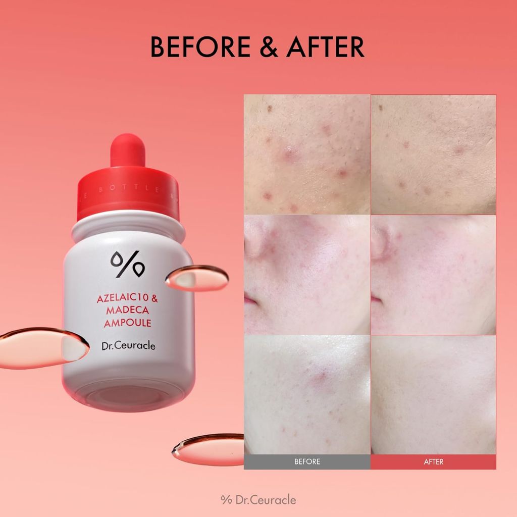 DR.CEURACLE AMPOULE 5 tipos, 30 ml (VEGAN BHA&MATCHA, NIACIN&RICE, AZELAIC10&MADECA, PDRN & RETINOL SHOT, GLUTATHIONE & NMN AMPOULE)