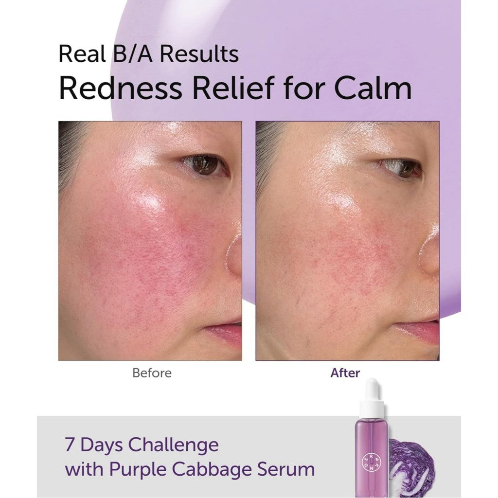 [NEW] SERUMKIND Purple Cabbage Serum, 30ml