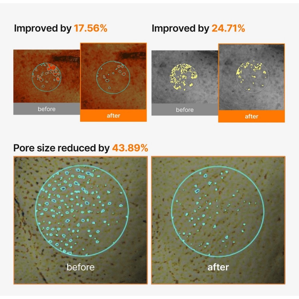 CELIMAX Pore+Dark Spot Brightening Cream Mask 2 Options