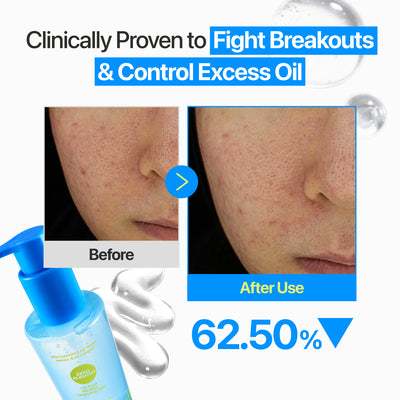 [NUEVO] numbuzin No.0 Zero Blemish Gel Limpiador Micelar Sin Aceite 200mL