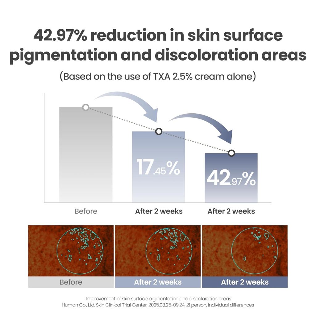 [NEW] AXIS-Y TXA 2.5% Intensive Brightening Cream, 50ml │ For Uneven Skin Tone · Deep Hydration