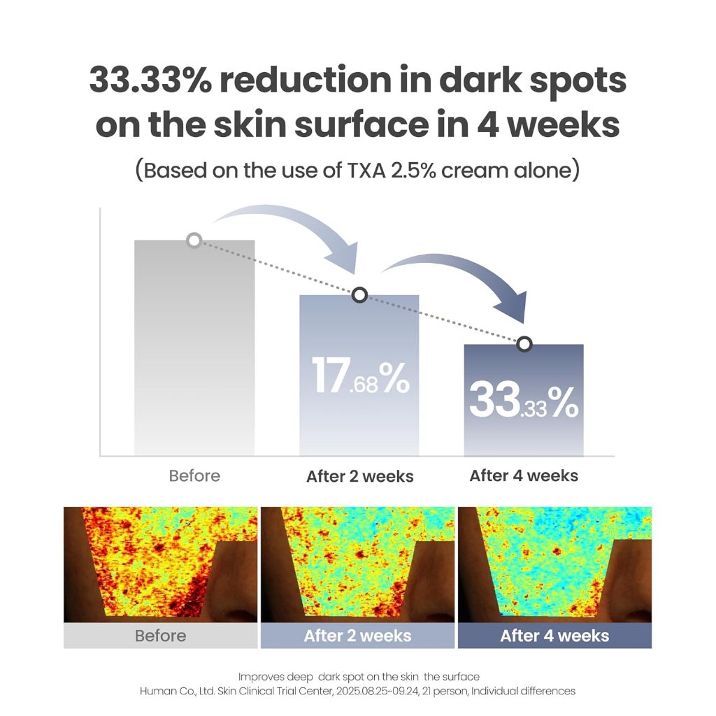 [NEW] AXIS-Y TXA 2.5% Intensive Brightening Cream, 50ml │ For Uneven Skin Tone · Deep Hydration