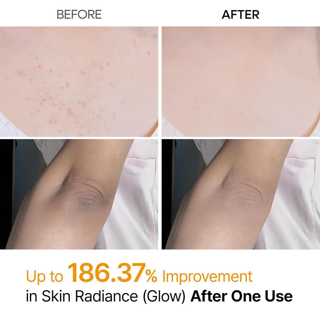 Dr. Melaxin Peel Shot Spray exfoliante con ácido kójico y cúrcuma 200 ml