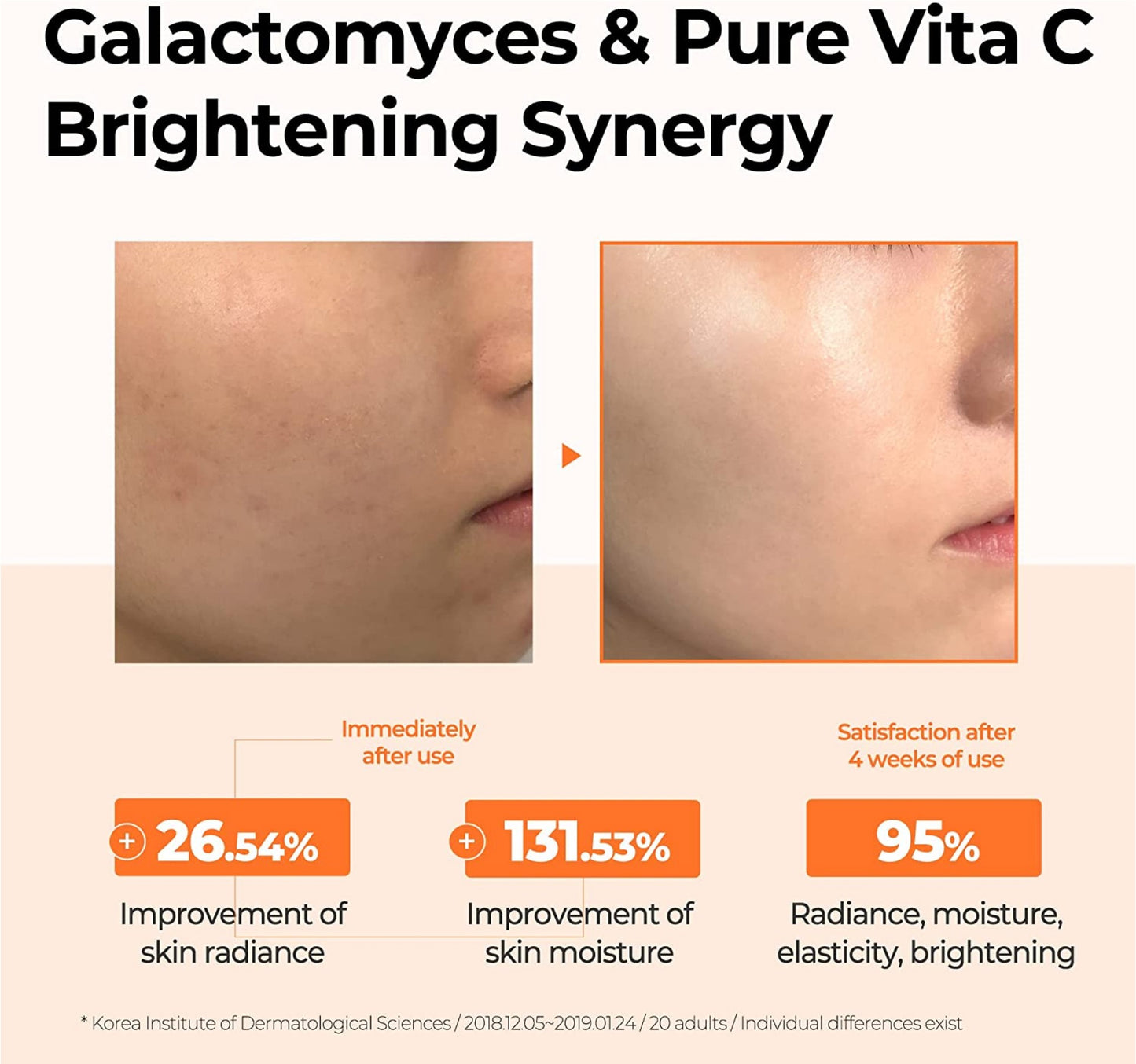SOME BY MI Galactomyces Pure Vitamin C Glow Toner 6.76Oz/200ml  Brightening and Refreshing Effect, Improvement of Skin Irritation and Elasticity, Korean Skin Care